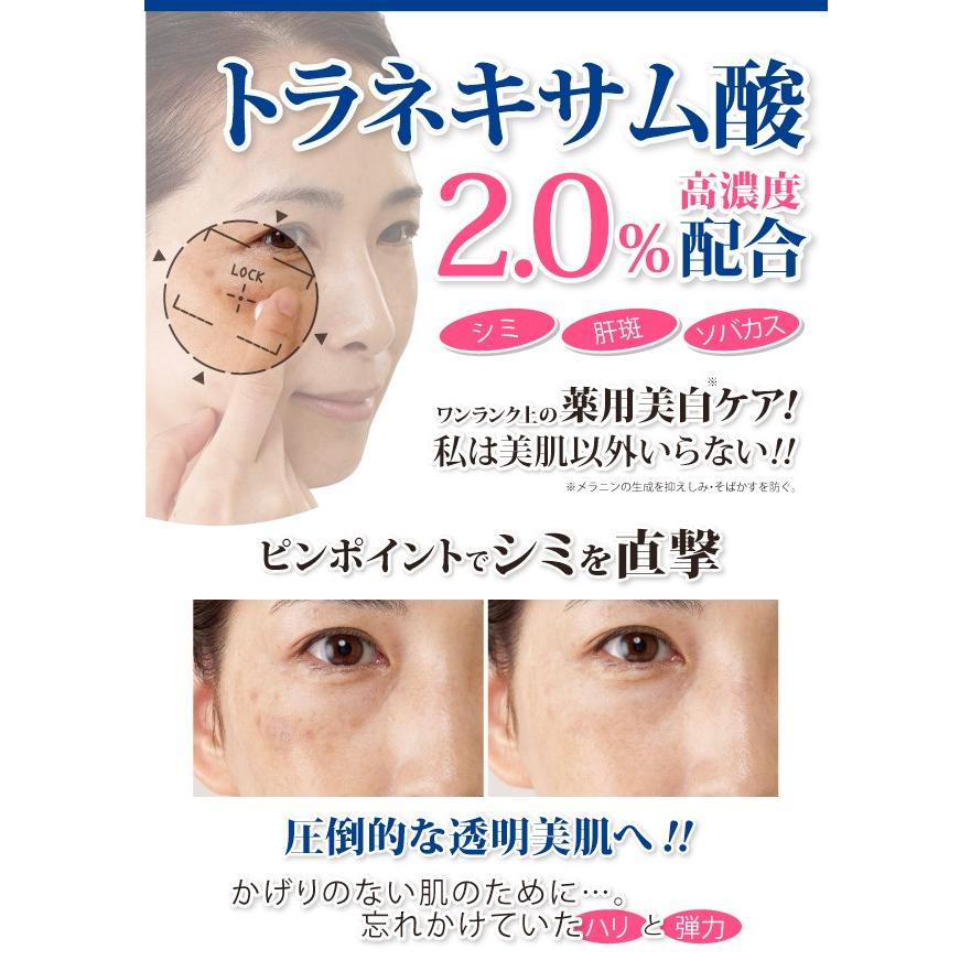 シミ 取り クリーム NEW 薬用トラシーミZ 30g増量版 ネコポス発送