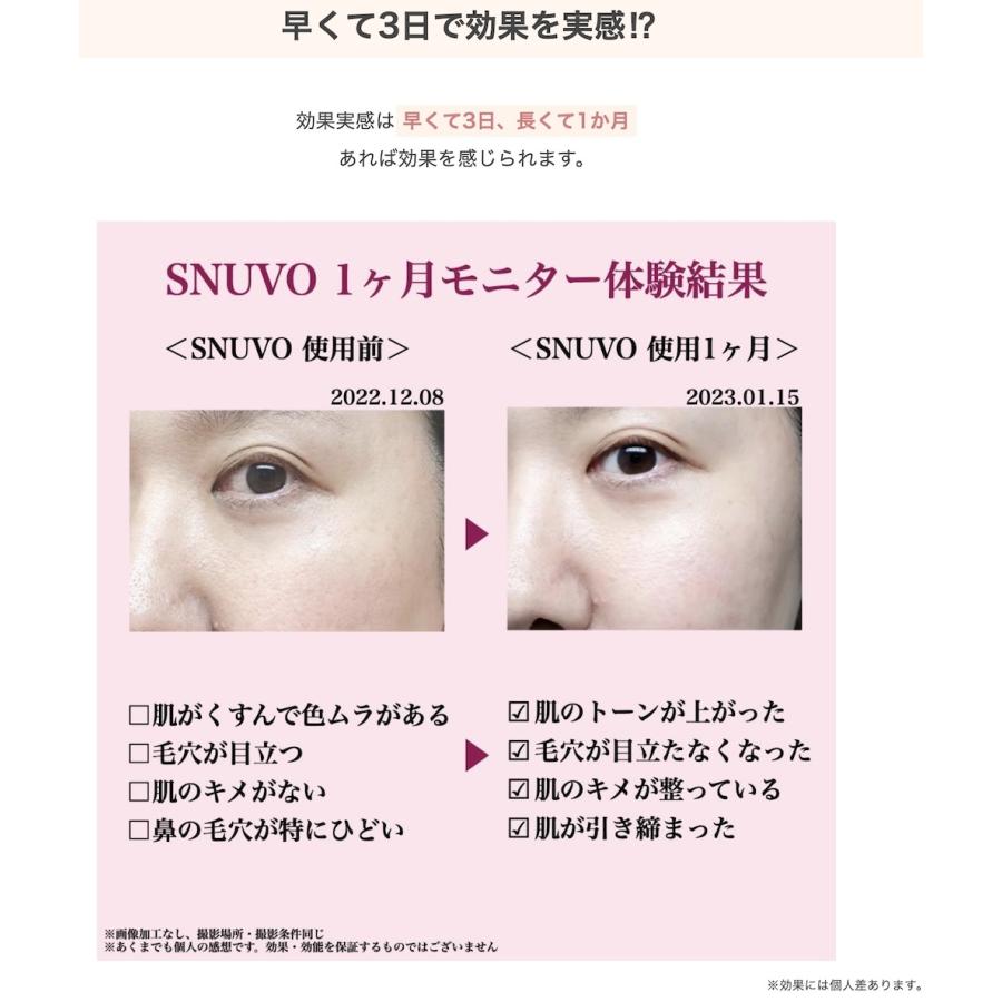 メーカー公認販売店 SNUVO(スヌーヴォ) 導入特化型美顔器 マルチ メーカー公認販売店 SNUVO(スヌーヴォ) 導入特化型美顔器 マルチ