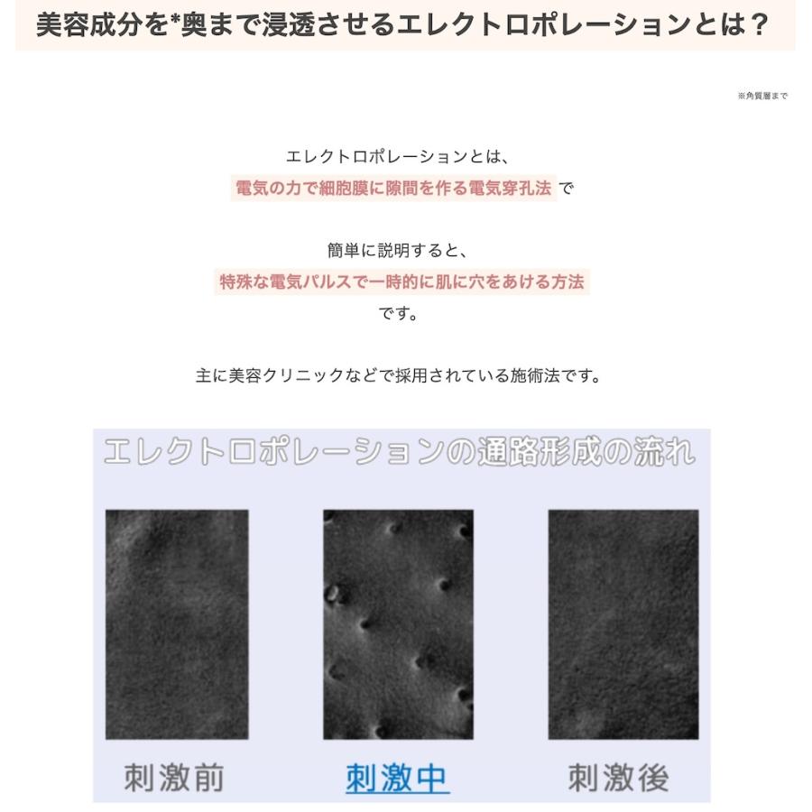 メーカー公認販売店 SNUVO(スヌーヴォ) 導入特化型美顔器 マルチ メーカー公認販売店 SNUVO(スヌーヴォ) 導入特化型美顔器 マルチ