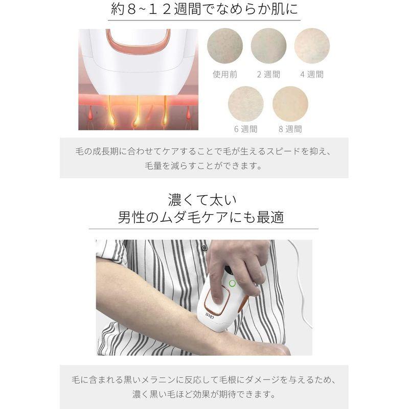 高評価 光 髭 メンズ レディース ムダ毛処理 セルフ 脱毛 家庭用 小型 Areti アレティ 脱毛器 Ipl E2108 光美容器 コンパクト 除 毛 脱毛器 Oroagri Eu