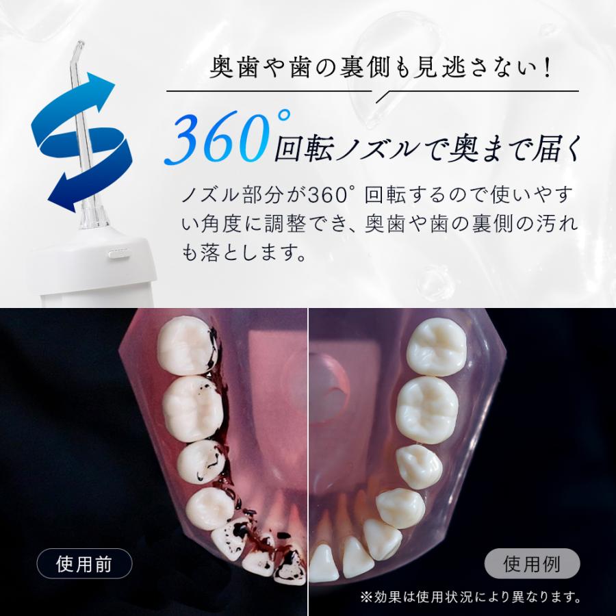 ジェットウォッシャー コンパクト 口腔洗浄器 USB充電式 携帯サイズ コードレス ジェット水流 デンタルケア IPX7防水 口内洗浄器 ウォーターフロス 手の平サイズの画像
