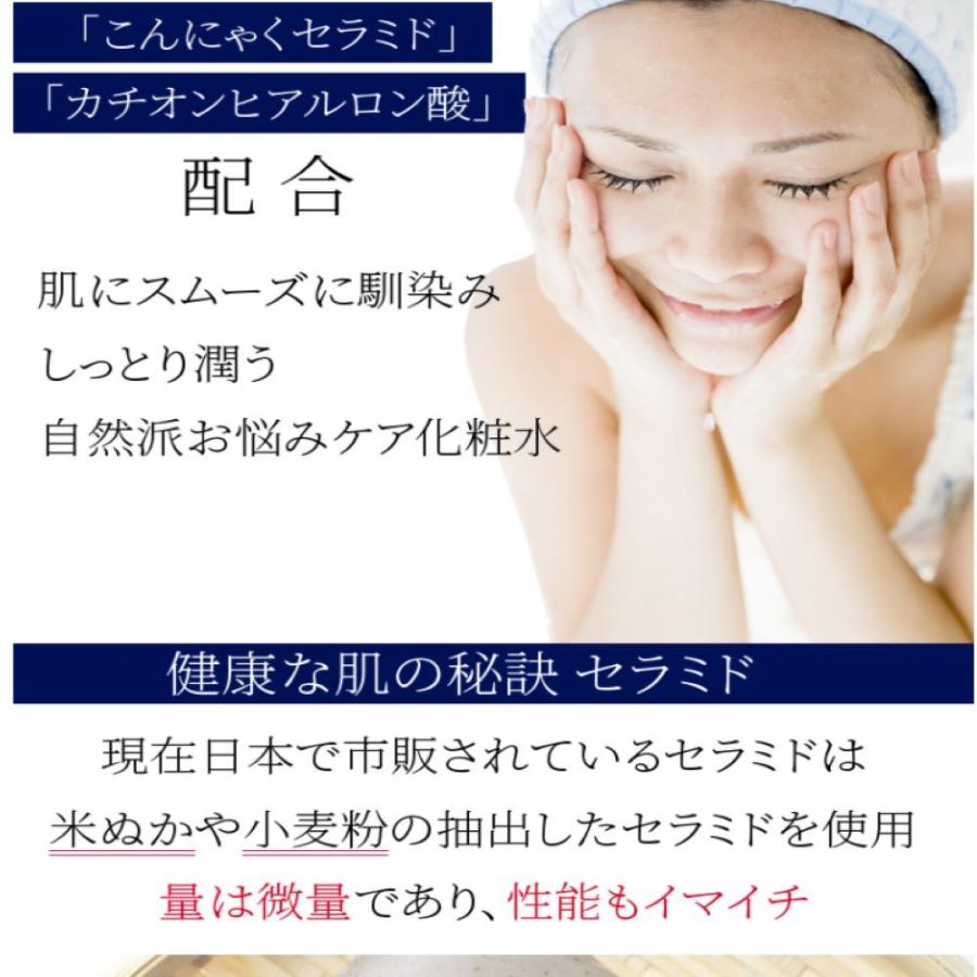 シェルミラック エッセンスローション150ml  化粧水 敏感肌 乾燥肌 |  | 02