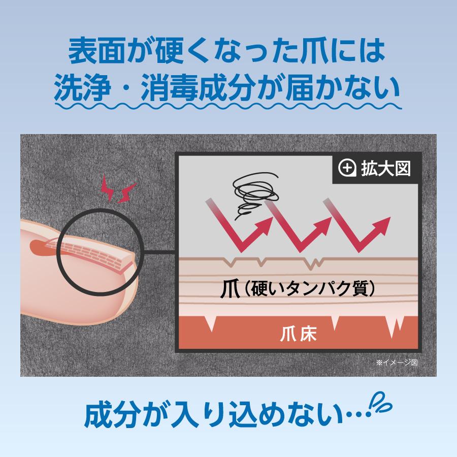 【新品未使用】リボネルEXプレミアム　爪ケア　8g　3本セット 新品未使用】リボネルEXプレミアム 爪ケア 8g 3本セット 新品未