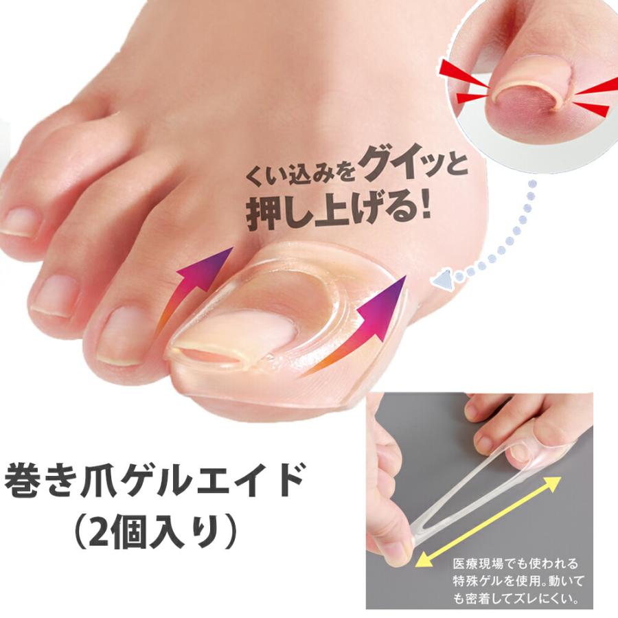 巻き爪ゲルエイド（2個入り）巻爪 対策 ゲル 自分で 巻き爪矯正 リフト