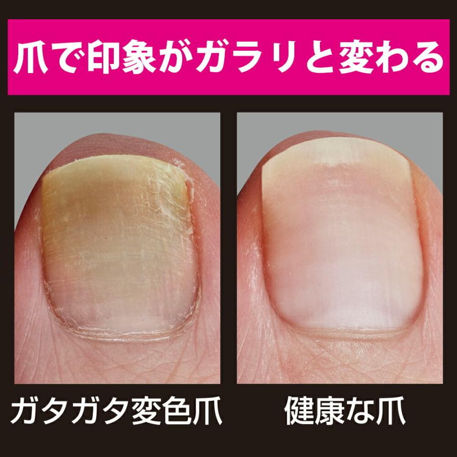 バブルクリアネイル 爪 つめ 変色 黄ばみ 乾燥 ガタガタ爪 まるモール 通販 Yahoo ショッピング