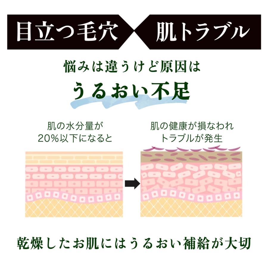 化粧水 保湿 ヒアルロン酸 大容量 べたつかない 全身 無香料 メーカー公式 3種のヒアルロン酸配合スキンローション 600ml |  | 08