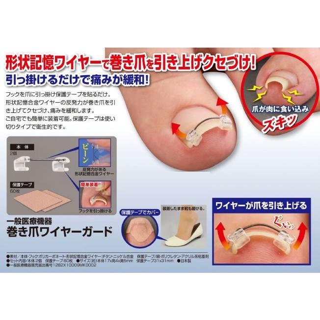 巻き爪ワイヤーガード 矯正 器具 ロボ ブロック ワイヤー 痛い 手術 爪切り ニッパー 皮膚科 治療 痛い ズキズキ 足の爪 食い込み Wat41 マツカメネット 通販 Yahoo ショッピング