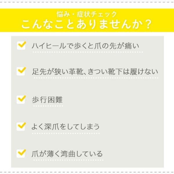 【巻き爪矯正】ドクターショール巻き爪用クリップ S/M/Lサイズ|マツヨシ|02