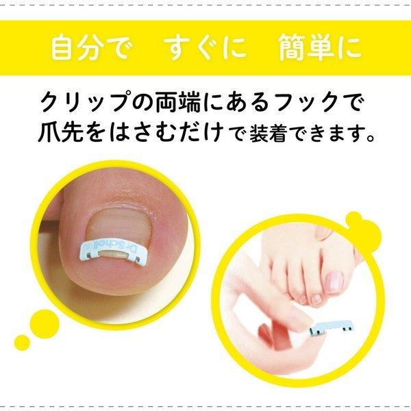 巻き爪矯正】【2個セット】ドクターショール巻き爪用クリップ S M Lサイズ マツヨシ - 通販 - PayPayモール 巻き爪矯正】【2個セット】ドクターショール巻き爪用クリップ S M Lサイズ マツヨシ - 通販 - PayPayモール
