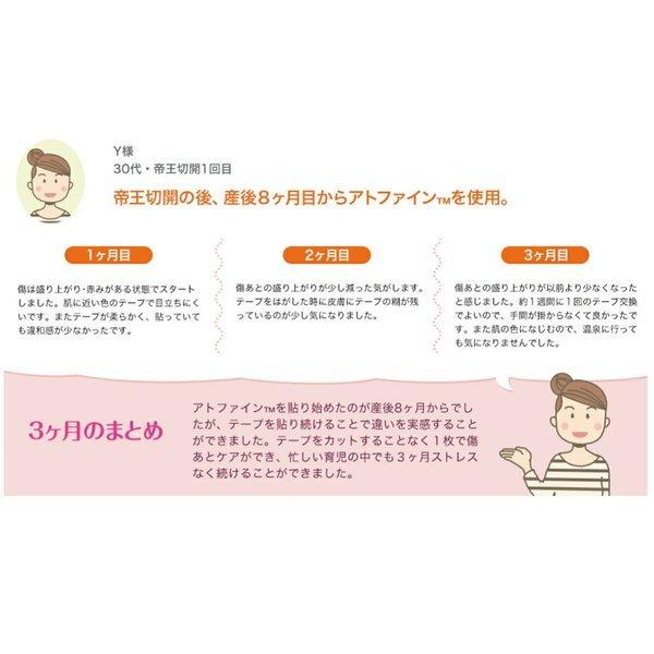 ニチバン アトファイン 4箱セット 帝王切開の傷 手術後 ケアテープ 傷 ファクトリーアウトレット 傷あと