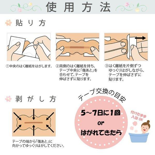 Web限定 ニチバン アトファイン Ss S M L Ll 帝王切開の傷 手術後 傷 傷あと ケアテープ 期間限定特価品