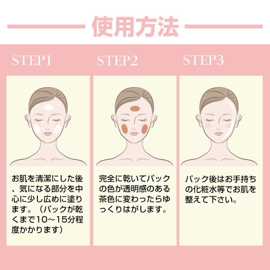 顔のシミ消し パック ピーリング 薬用 美白 ピールホワイトEX 30g 医薬