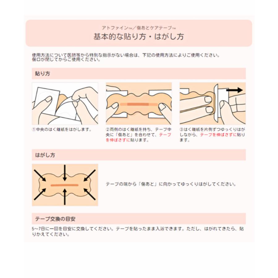 ニチバン　アトファイン　Ato fine　Sサイズ（1〜４ｃｍの傷あとに）１２枚入　C｜mb-web｜03