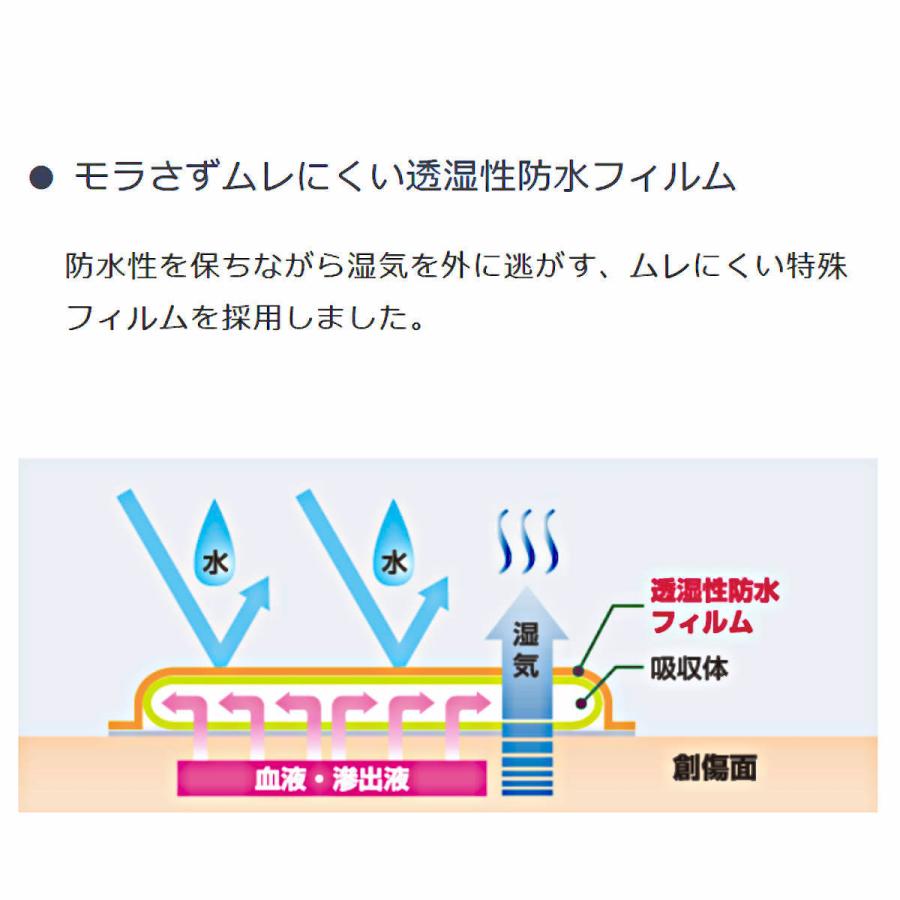 白十字 白十字 シングルパッドA 2630(滅菌済) 1枚パック×15入 白十字 白十字 シングルパッドA 2630(滅菌済) 1枚パック×15入