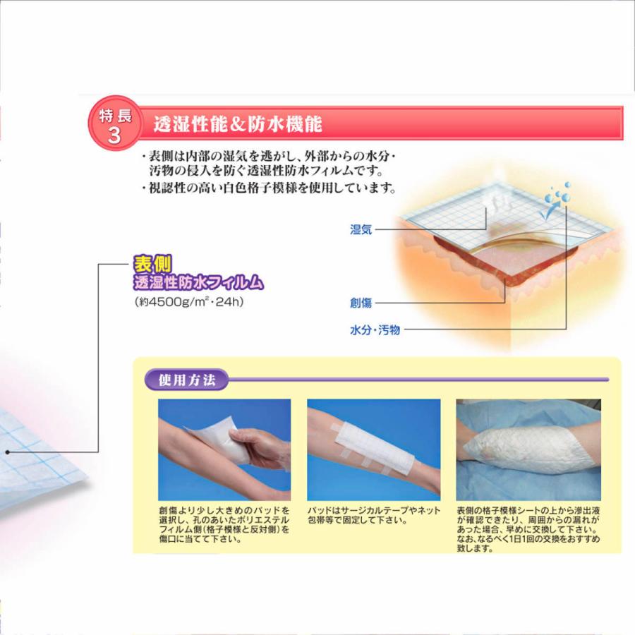 白十字　モイスキンパッド　7520　滅菌済　1枚パック×30入　B | 白十字 | 06