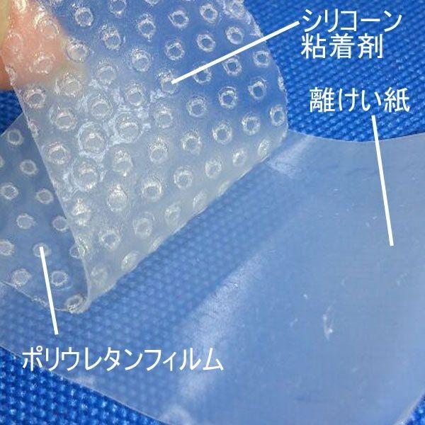 パーミロール11箱 smith＆nephew（スミス・アンド・ネフュー） オプサイト ジェントル