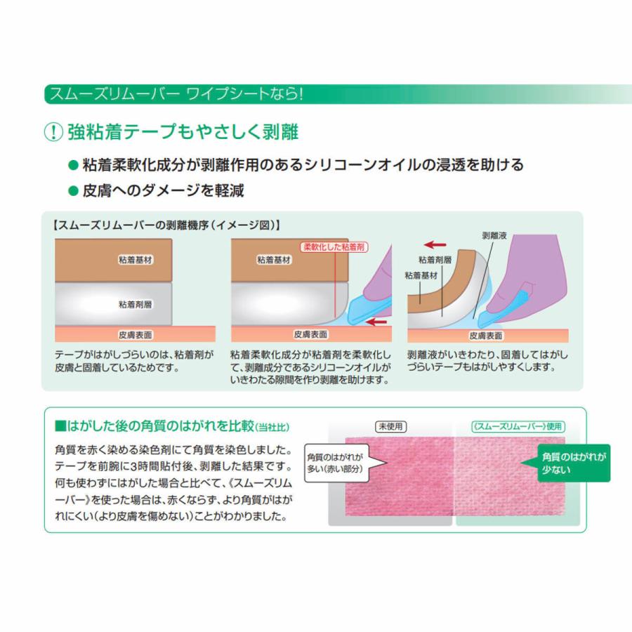 ALCARE（アルケア） スムーズリムーバー ワイプシート50枚入（非