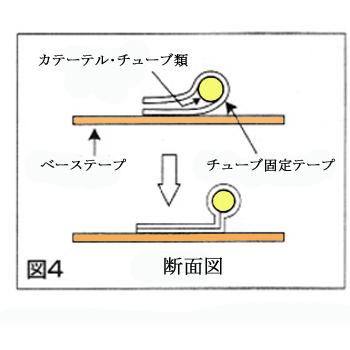 アルケア　クイックフィックス　3号（36Fr以下　カテーテル固定テープ）100枚入　＃19394｜mb-web｜04