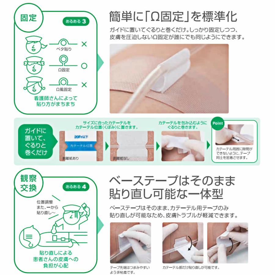 アルケア　クイックフィックス　3号（36Fr以下　カテーテル固定テープ）100枚入　＃19394｜mb-web｜07