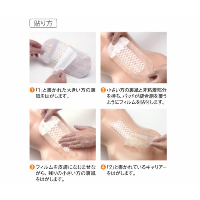 smith＆nephew（スミス・アンド・ネフュー） オプサイト POST-OP