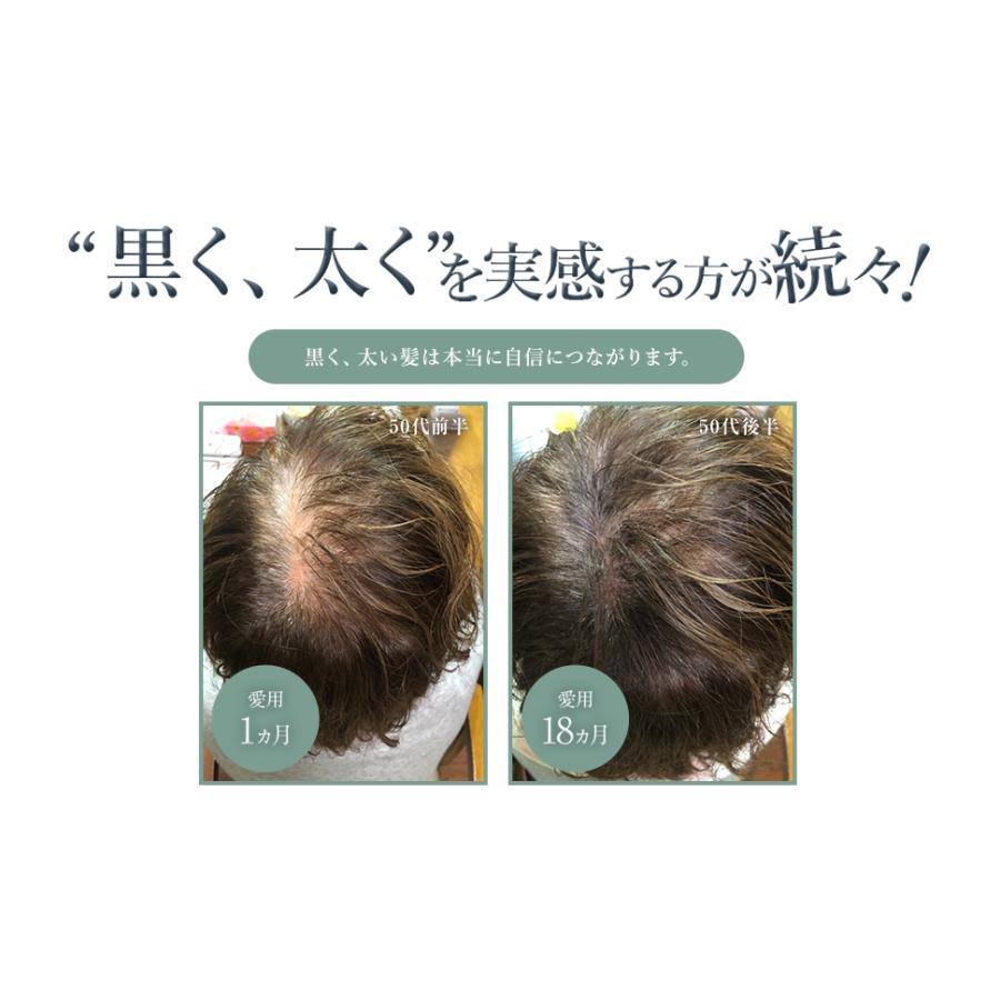 薄毛 白髪 対策 薬用 育毛剤 GROXIL ヘアトニック(1本) 医薬部外品