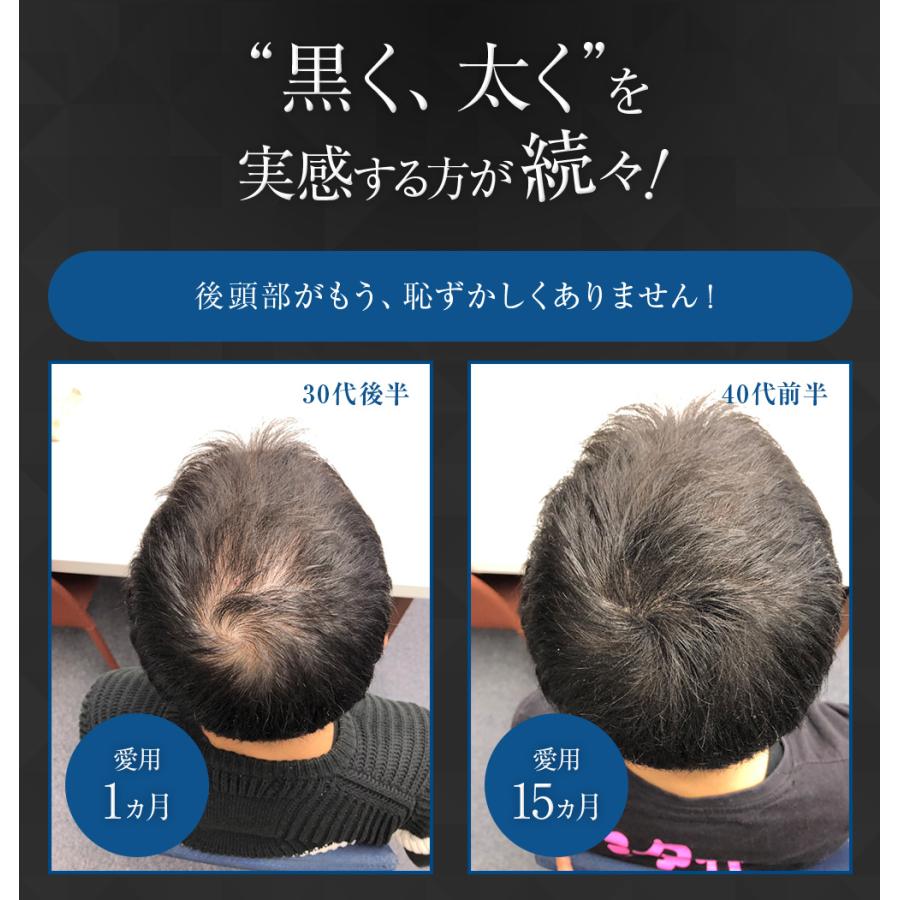 薄毛 白髪 対策 薬用 育毛剤 Groxil ヘアトニック 1本 医薬部外品 男女兼用 発毛剤 養毛剤 男性用 女性用 抜け毛 予防 男性 女性 50代 60代 グロキシル G0001 Y マスター コスメティック公式 通販 Yahoo ショッピング