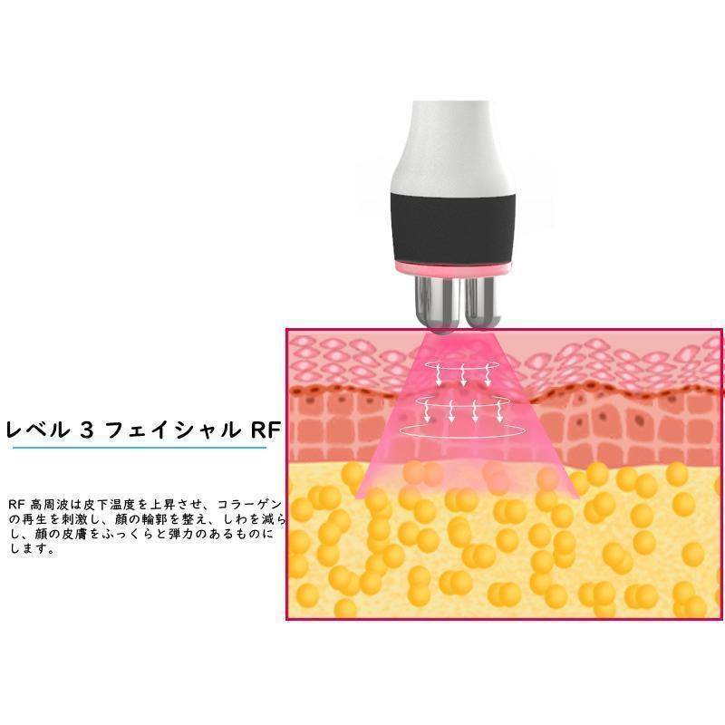 デジタル美顔器 3in1 40Khzキャビテーション＋ラジオ波 簡単操作