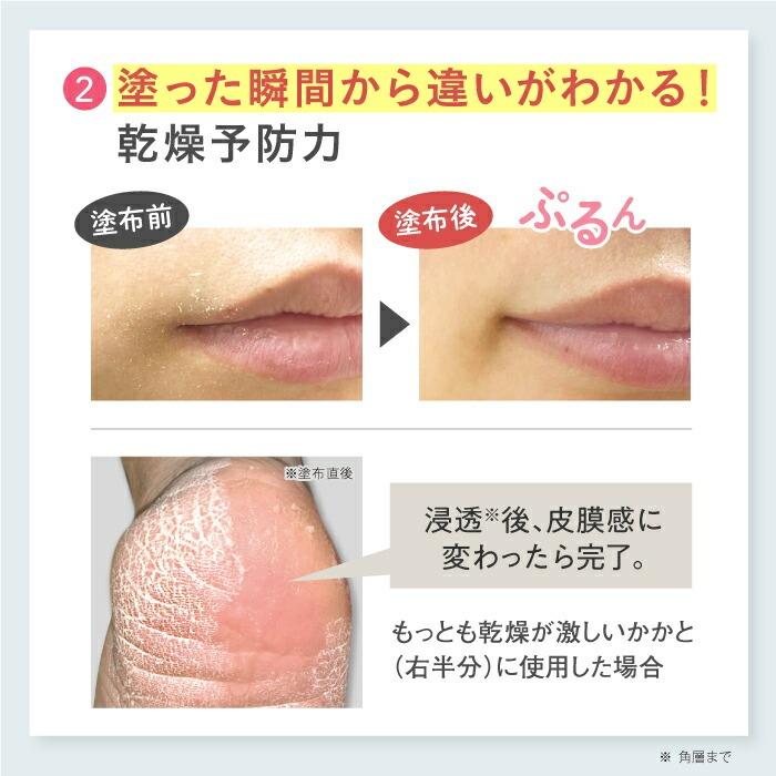 【公式】メディプラス オールインワンジェル 180g (約2か月分) オールインワンゲル mediplus 保湿 乾燥肌 敏感肌 ビタミンC 美容液 乳液 メンズ レディース | Mediplus | 06