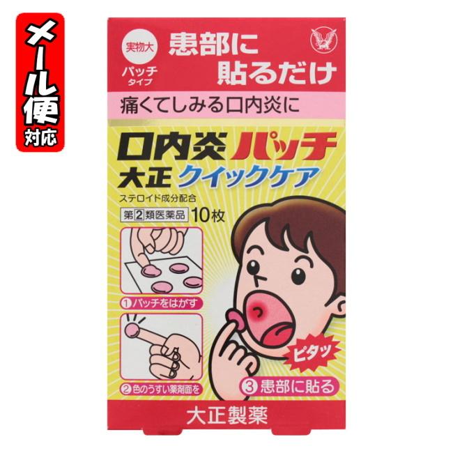 【メール便09】[★self] 口内炎パッチ大正クイックケア (10枚入) 大正製薬【指定第2類医薬品】 の商品画像