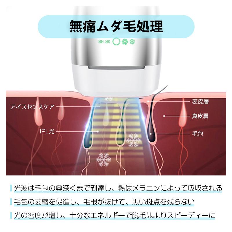 明誠 IPL脱毛器 冷感 冷却機能 5段階強度調節 無痛脱毛 スキンケア