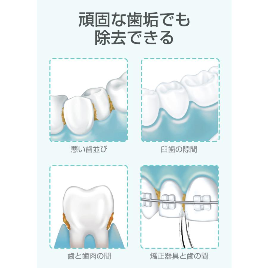 口腔洗浄器 ジェットウォッシャー 口腔洗浄機 据え置き 5つモード調節可能 防水 携帯型 歯間ジェット 歯周ポケット 洗浄 歯垢除去 USB充電式｜meiseishop｜05