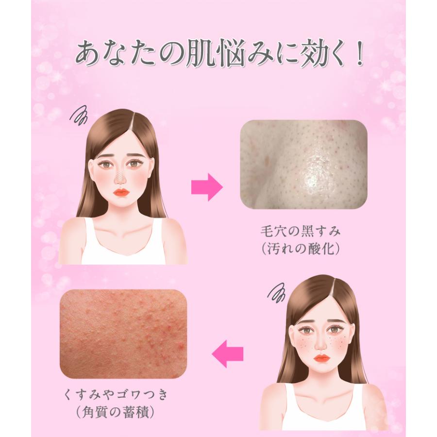 明誠 ウォーターピーリング 超音波 EmS イオン導出導入 美顔器 汚れや