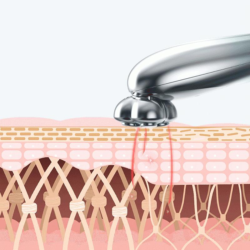 明誠 目元美顔器 RFラジオ波 美顔器 EmS美容器 目元アンチエイジング