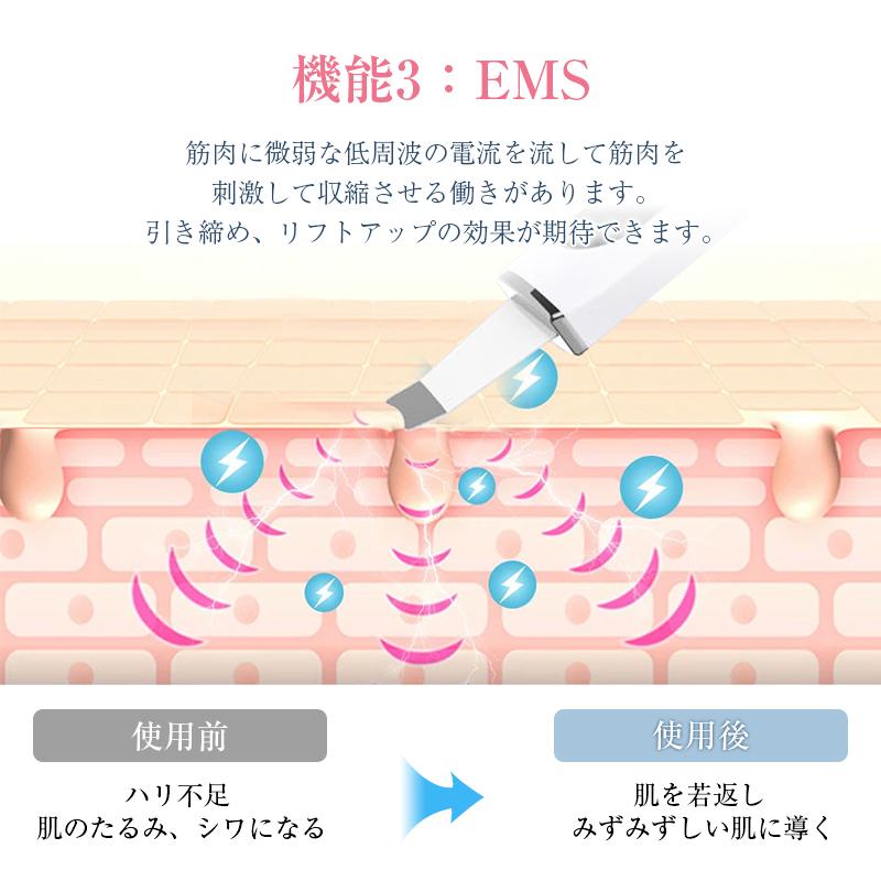 明誠 ウォーターピーリング 多機能 EmS 美顔器 毛穴洗浄 超音波