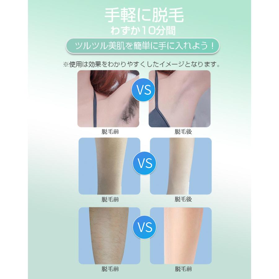 脱毛器 フラッシュ脱毛 IPL脱毛器 ムダ毛処理 全身用 ビキニライン 美肌効果 家庭用脱毛器 60万回フラッシュ 無痛脱毛 6段階出力【PL保険加入済み製品・安心】 | 明誠 | 16