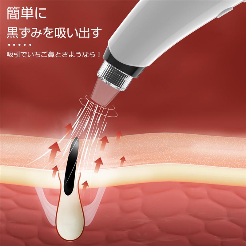 明誠 毛穴吸引器 フェイスローラー ニキビ吸引 黒ずみ吸引 美肌効果 肌