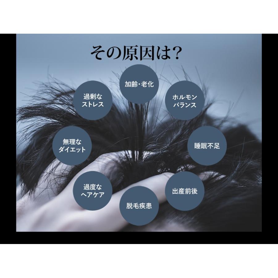 ｄｏｔ. 育毛剤 Ｂ薬用ヘアエッセンス 育毛 発毛促進 養毛 薄毛 抜け毛予防  男性用 女性用 男性 女性 |  | 03