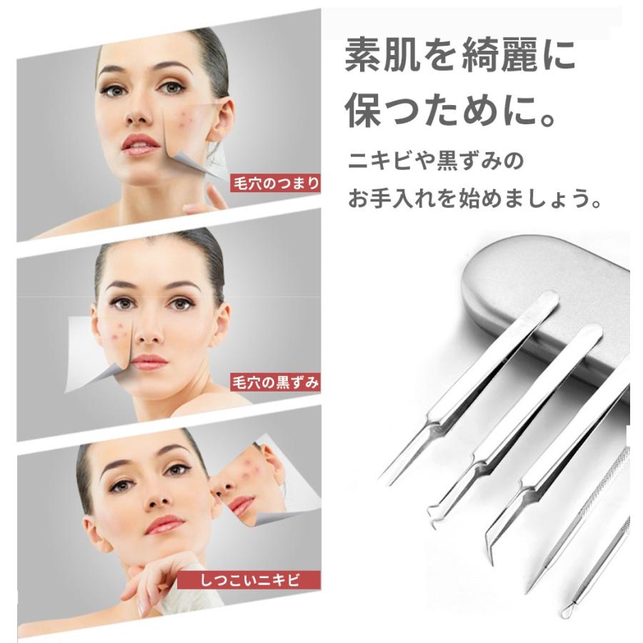 毛穴ケア専用キット 5本セット 角栓取り 器具 ニキビ取り コメドプッシャー ピンセット ケース付き プロ仕様 抗菌ステンレス いちご鼻 黒ずみ 除去 01-05-0025 WONDER LABO 通販 角栓取り 5本セット ニキビケア 除去 プッシャー 黒ずみ スキンケア コメド