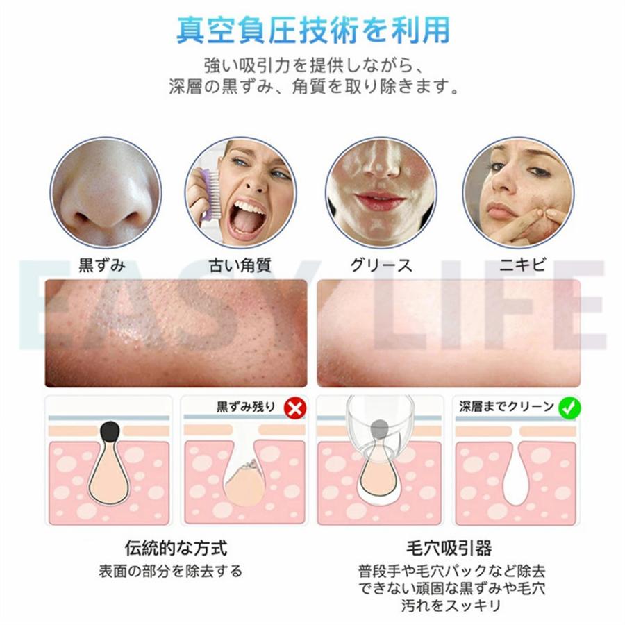 評判 22新型 毛穴吸引器 美顔器 毛穴クリーナー クリーン イチゴ鼻 角栓 5種類の吸引ヘッド 5段階吸引力調整 Usb充電式 口コミ 保湿 毛穴ケア メンズ 日本製 防水 Aynaelda Com