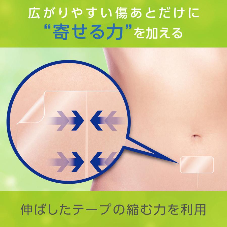 共和 アトレスケア No.S10 25mmx50mm YB-Q2550S1 お試し用 1箱10枚