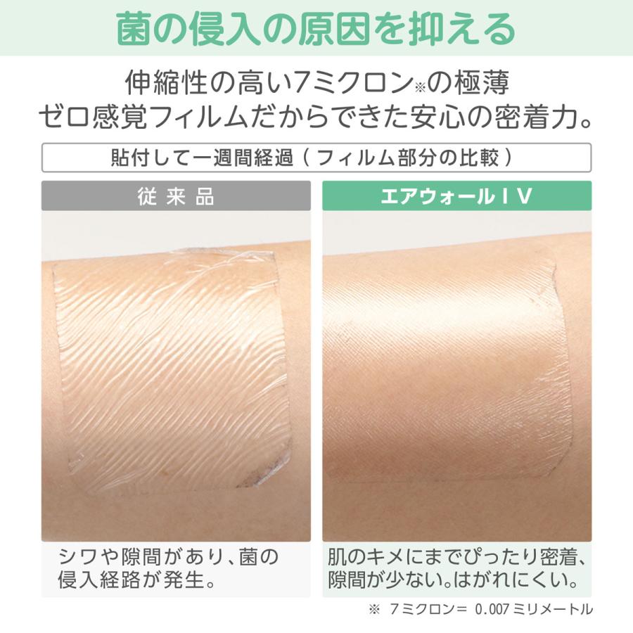 skinix エアウォールIV 切り込みタイプ 滅菌済 NO.70V 70mmx90mm skinix エアウォールIV 切り込みタイプ 滅菌済 NO.70V 70mmx90mm