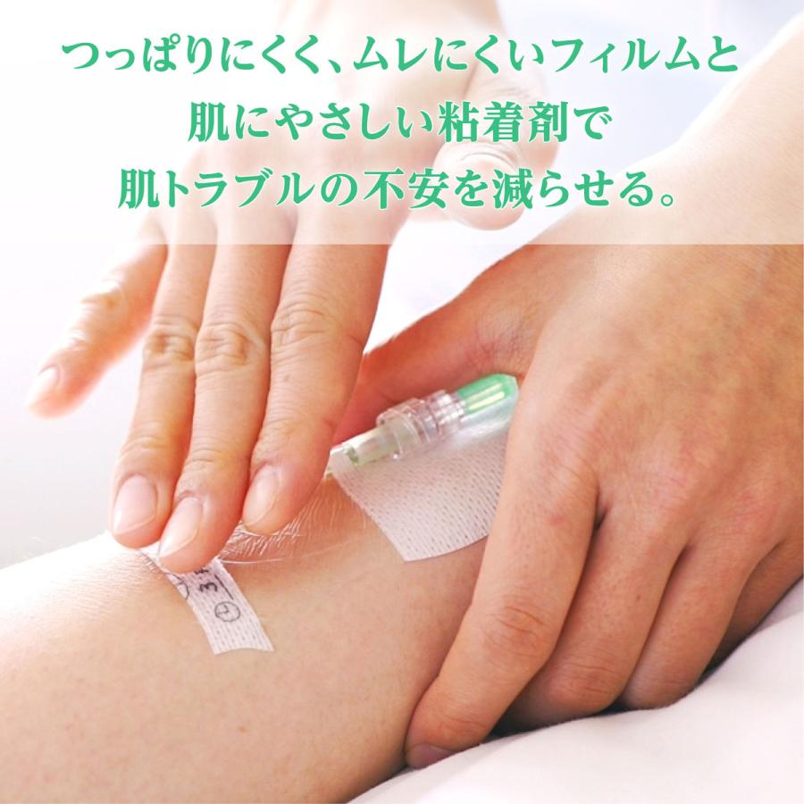 skinix エアウォールIV 切り込みタイプ 滅菌済 NO.70V 70mmx90mm skinix エアウォールIV 切り込みタイプ 滅菌済 NO.70V 70mmx90mm