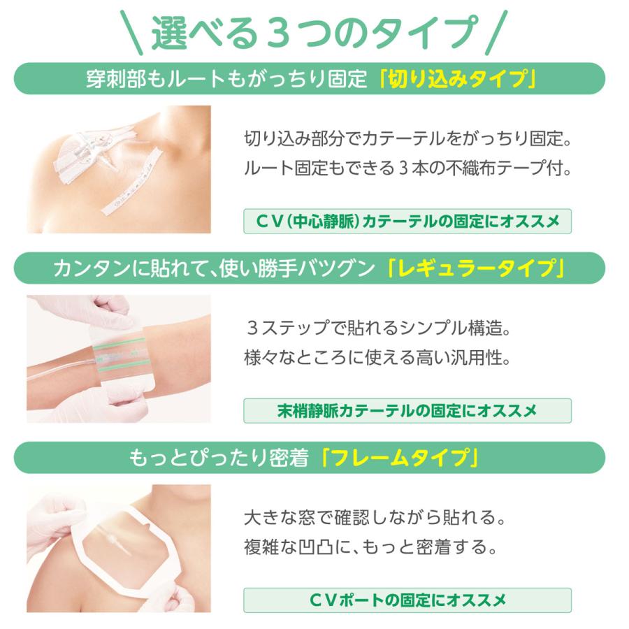 skinix エアウォールIV フレームタイプ 滅菌済 NO.70F 70mmx60mm skinix エアウォールIV フレームタイプ 滅菌済 NO.70F 70mmx60mm