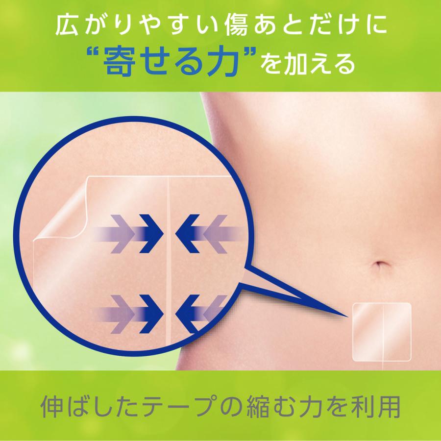 skinix アトレスケア No.M30 50mmx50mm YB-Q5050S 1箱30枚 共和【返品