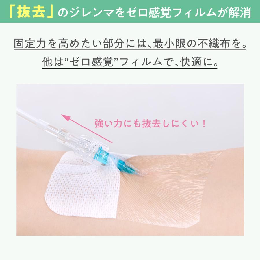 skinix エアウォールIV 切り込みタイプ 60×80mm 1箱100枚 カテーテル