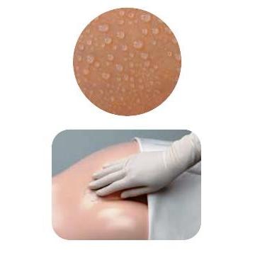 smith＆nephew（スミス・アンド・ネフュー） セキューラPO 撥水性