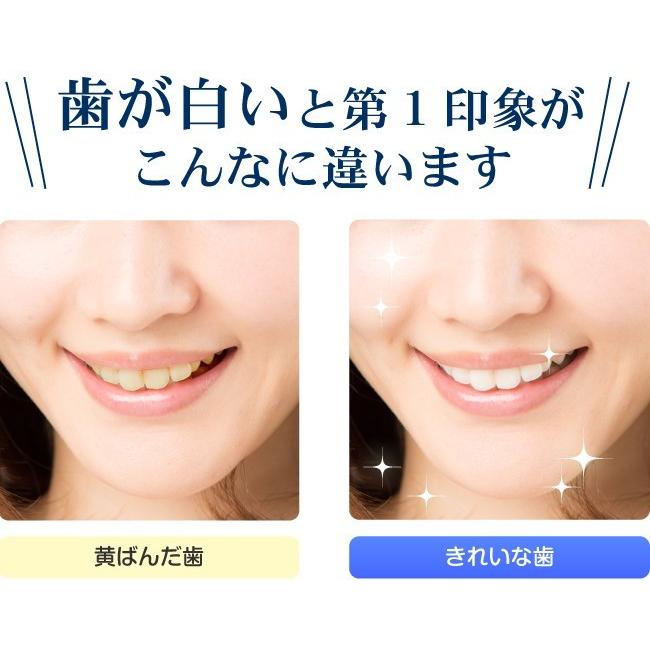 歯のホワイトニング ヤニ取り 歯磨き粉 歯みがき美容液 薬用トゥースクリアホワイト 自宅 持ち歩き兼用 Tooth Fst メリカ オンラインショップ 通販 Yahoo ショッピング