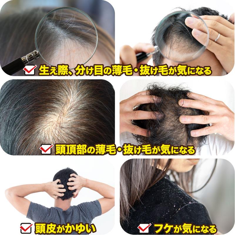 育毛剤 医薬部外品 MERIDIAN-メリディアン-6本セット 薬用育毛剤 男性用 女性用 |  | 05