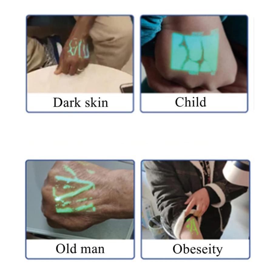 赤外線静脈ファインダー ビューアー LED 静脈ファインダー、静脈ファインダー ビューアー、看護師瀉血用ハンドヘルド静脈ロケーター検出器     商品情報    赤外線静脈ファインダー ビューアー LED 静脈ファインダー、静脈ファインダー ビューアー、看護師瀉血用ハンドヘルド静脈ロケーター