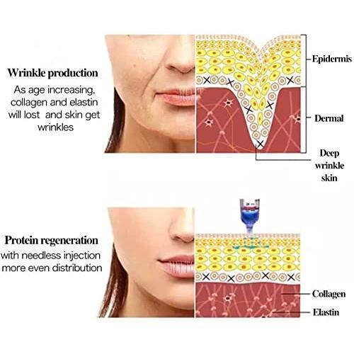 ヒアルロンペンヒアルロンペン、しわの除去と唇の肥厚のための注射、ヒアルロン酸シリンジアトマイザー、圧力マシン、保湿ホワイトニングの除去 ヒアルロンペンヒアルロンペン しわの除去と唇の肥厚のための注射 ヒアルロン酸シリンジアトマイザー 圧力マシン 保湿ホワイトニングの除去